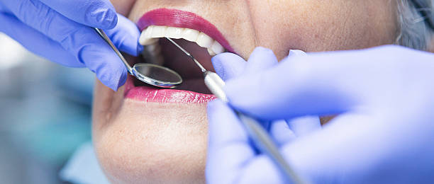 Best Emergency Treatment for Toothache in Tyndall Af, FL